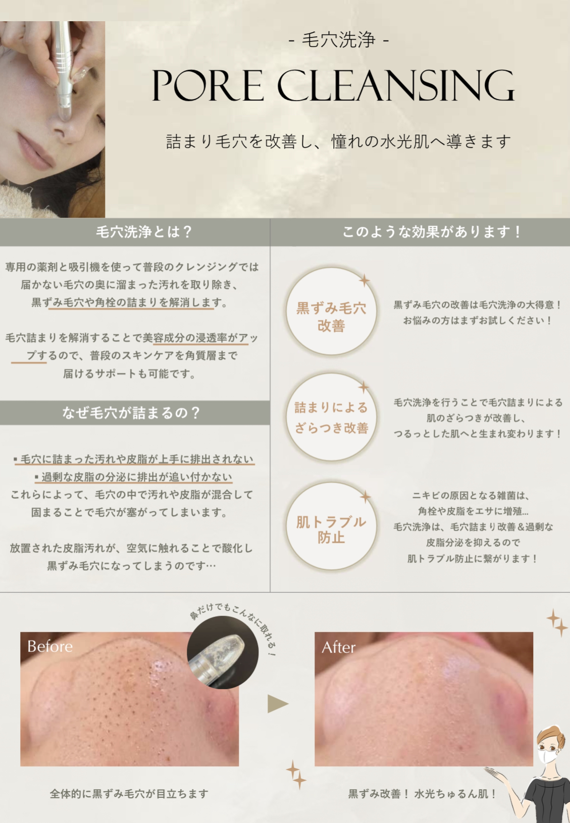 浜松店新メニュー「毛穴洗浄」